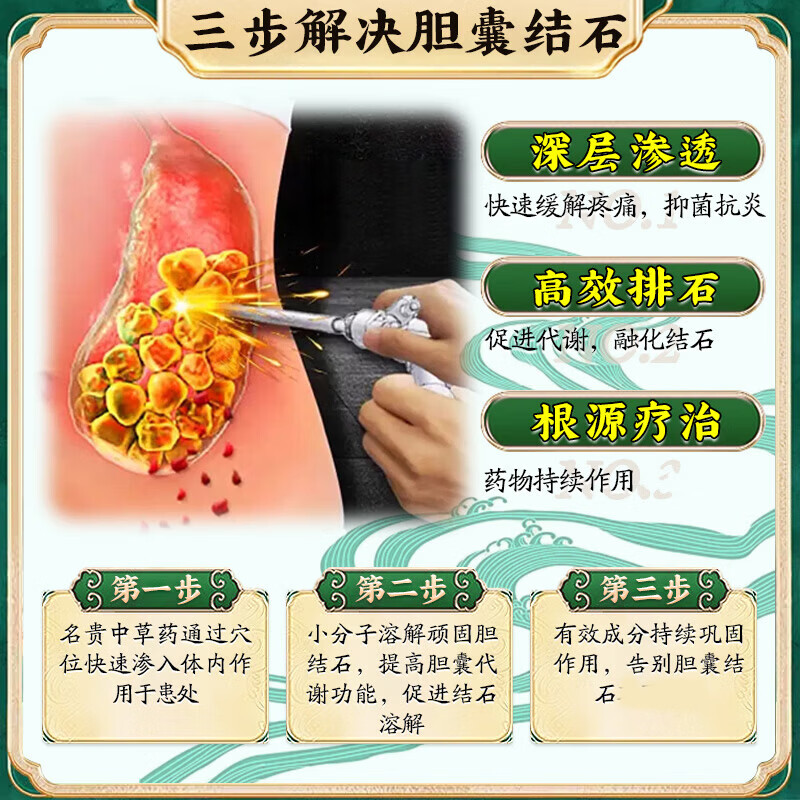 久研制药胆结石排石药胆囊结石进口的药胆囊息肉日本消石素专用胆囊炎膏药 日本研发结石贴【1盒12贴】 胆结石排石胆囊结石进口的药