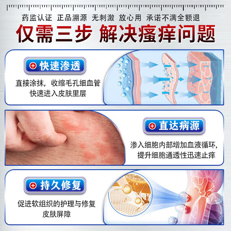 伊藤薬制日本炉甘石抑菌止痒皂全身瘙痒湿痒湿诊真菌感染止痒皂全身体适用 一盒【日本进口】炉甘石抑菌止痒膏 炉甘石软膏婴儿儿童止痒乳膏湿疹热疹
