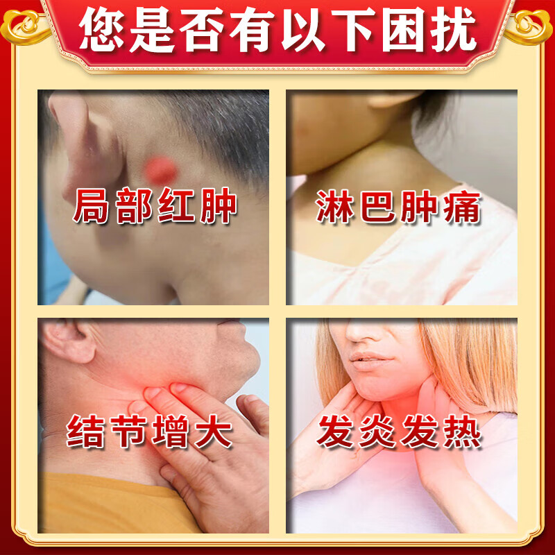 淋巴结散结膏淋巴结膏专用颈部肿大发炎消炎药脖子颈部散结膏 一盒装