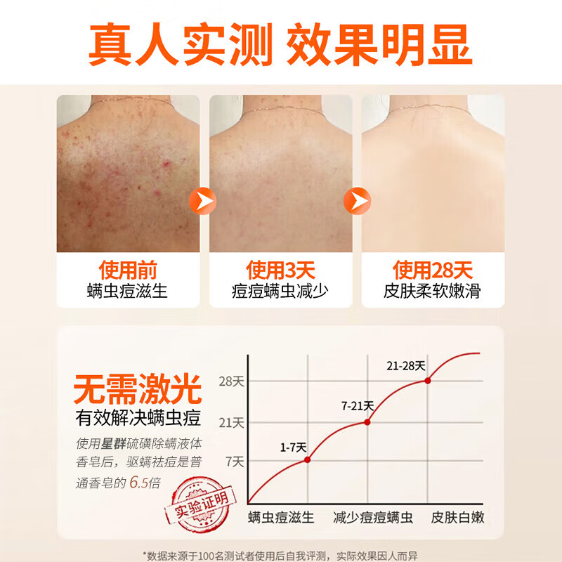 星群白云山侧柏叶洗发皂何首乌香皂控油洗头皂草本中药手工皂沐浴药皂 硫磺除螨沐浴露红色2瓶【实用装】 注：发皂赠【起泡网】沐浴露不送【起泡网】