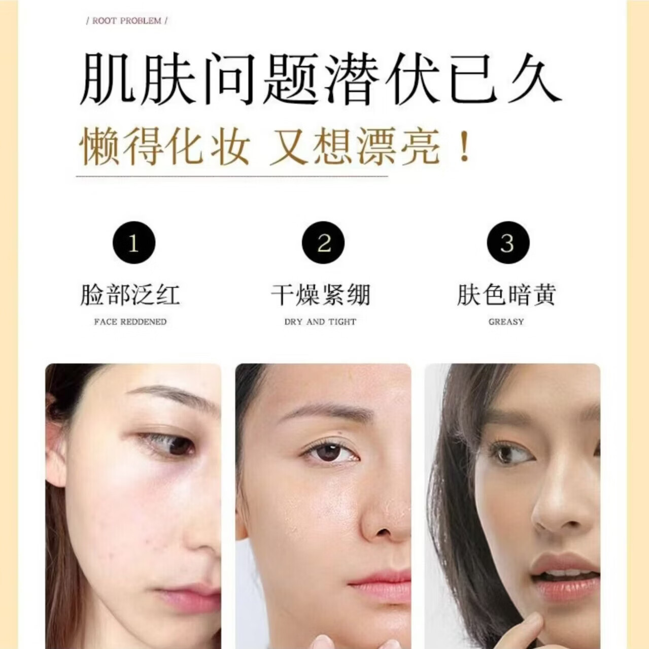 阳光密码-草本清肌霜控油祛痘修护套装 一套基础装