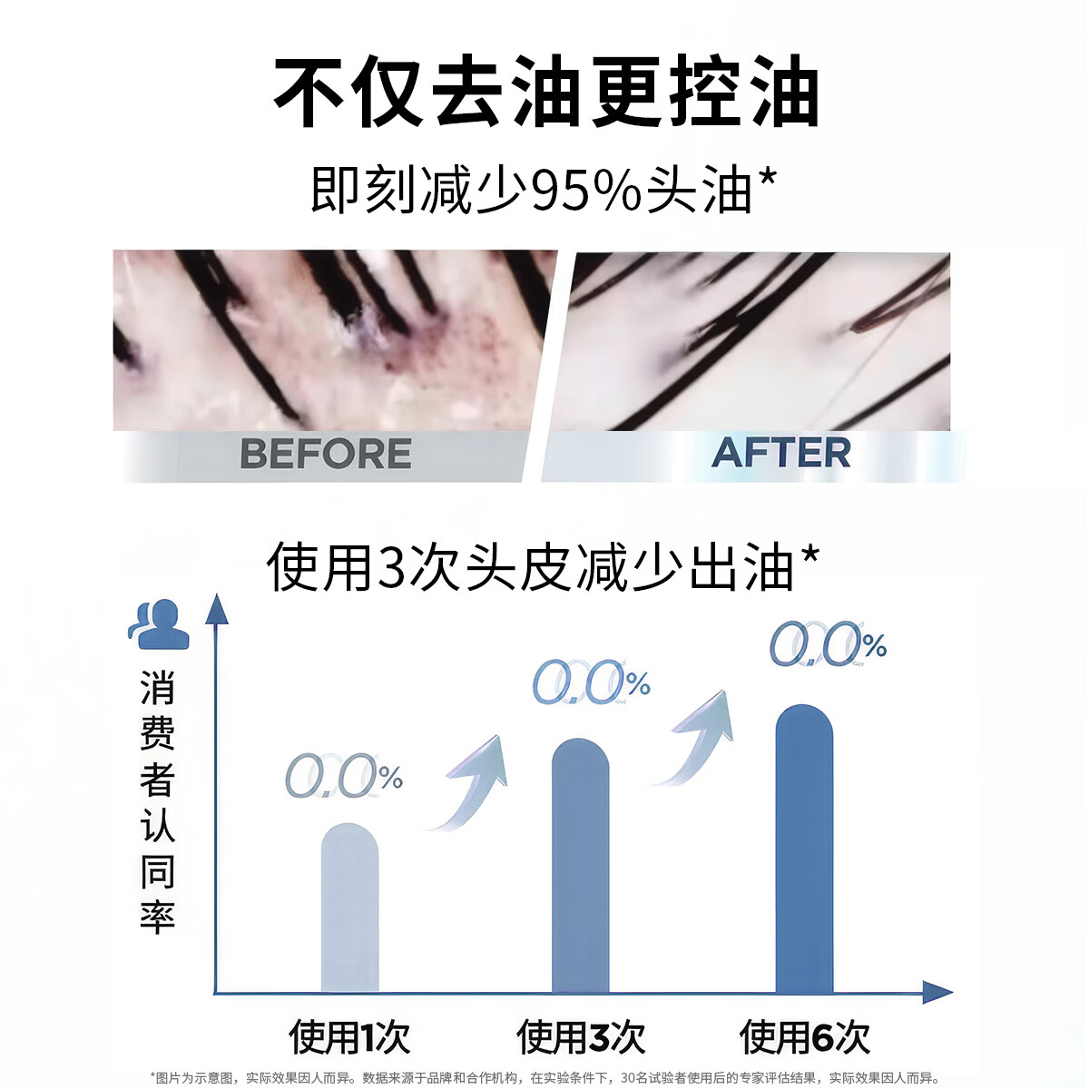 蒂花之秀玻尿酸香氛去屑洗发水控油蓬松柔顺修护大容量 去屑洗发水720g+洗护洗发乳450g