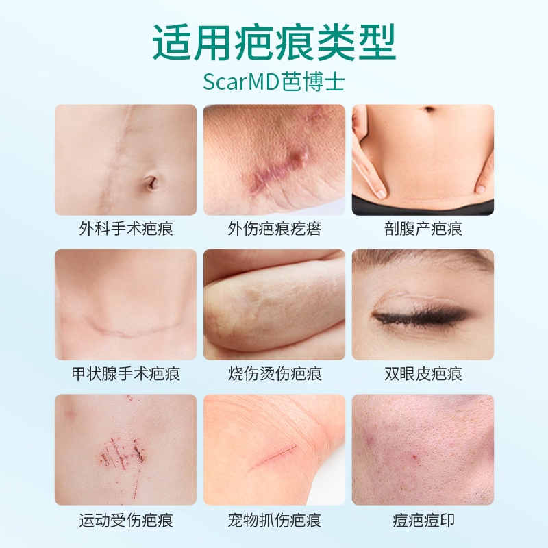 芭博士ScarMD美国进口祛疤膏医用剖腹产修复疤痕膏儿童硅酮凝胶软膏 升级版-滚珠款15g 【送硅凝胶+帆布袋】