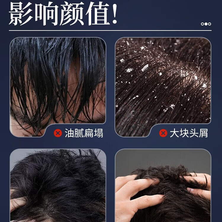 七绿(SEVENGREEN)男士古龙香皂清爽除螨控油去屑止痒洗发皂敏感肌适用 【单块便携装】七绿洗发皂 去屑止痒 出差随身