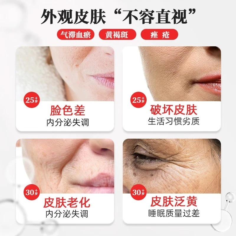 [晶珠]景天祛斑胶囊 0.5g*30粒 3盒装 0.5g*30粒/盒【顺丰包邮】 活血行气祛斑消痤 黄褐斑痤疮 药房直售 顺丰包邮