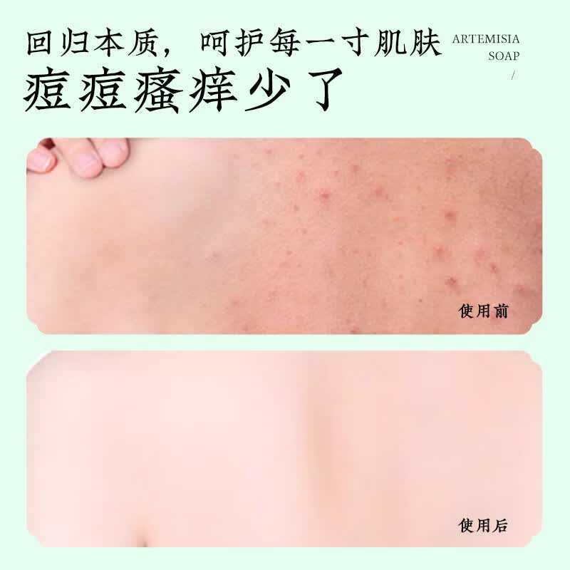 兴宛堂艾草香皂正品官方品牌女男士洗脸沐浴洗澡洁面专用艾叶精油皂肥皂 【清润降燥】艾草药皂5块（送起泡网）