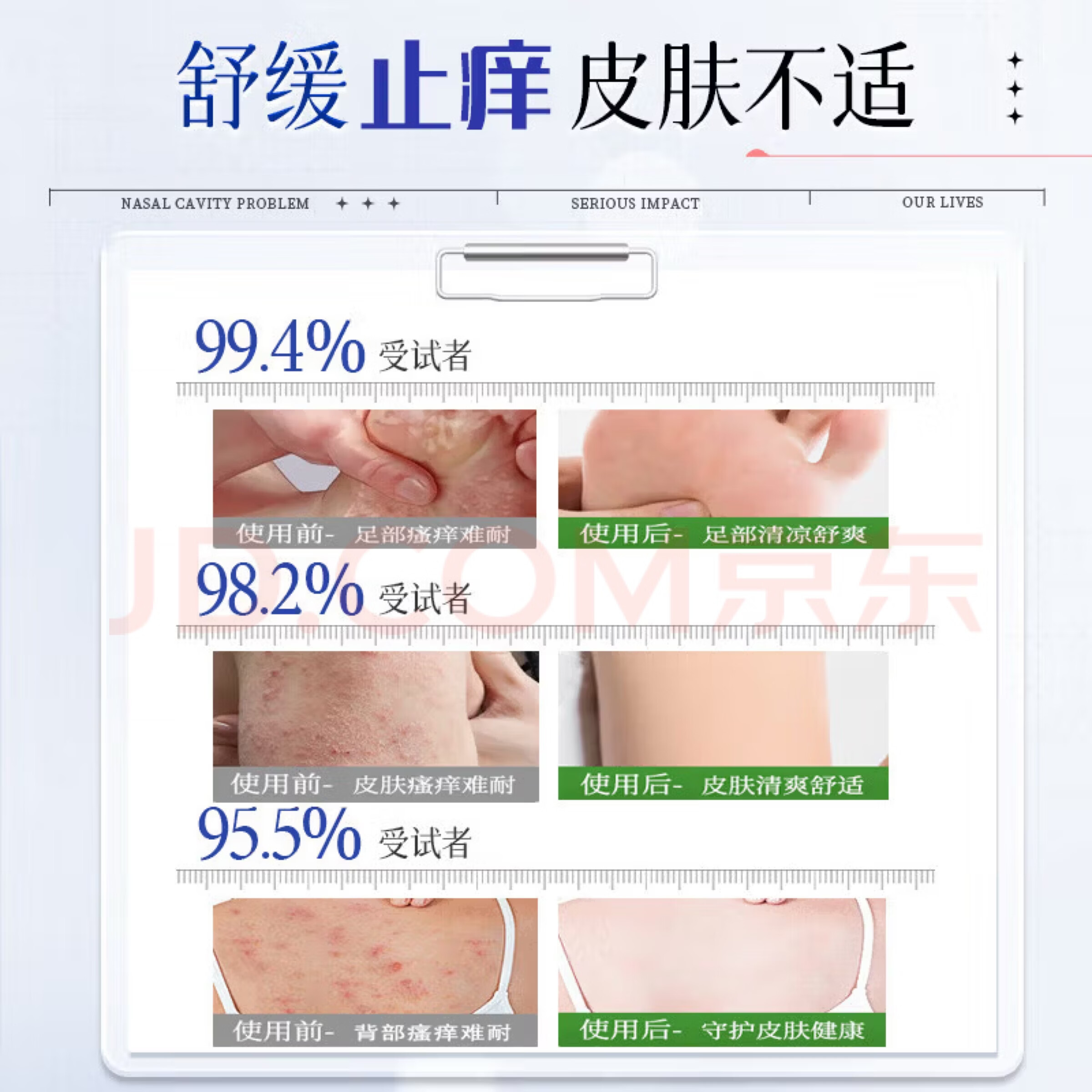 【日本炉甘石】特效皮肤瘙痒止痒乳膏全身体适用无激素天然草本膏 买7送8【季度装】常年痒