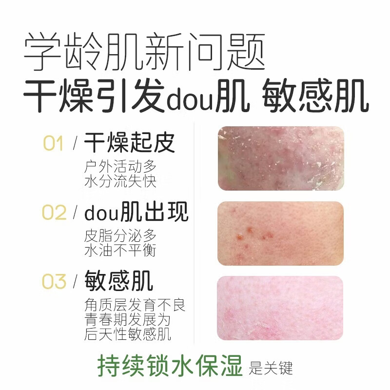 松达儿童面霜婴儿山茶油霜保湿补水宝宝面霜护肤润护秋冬季面霜 【套装更划算】润护霜50g*2瓶