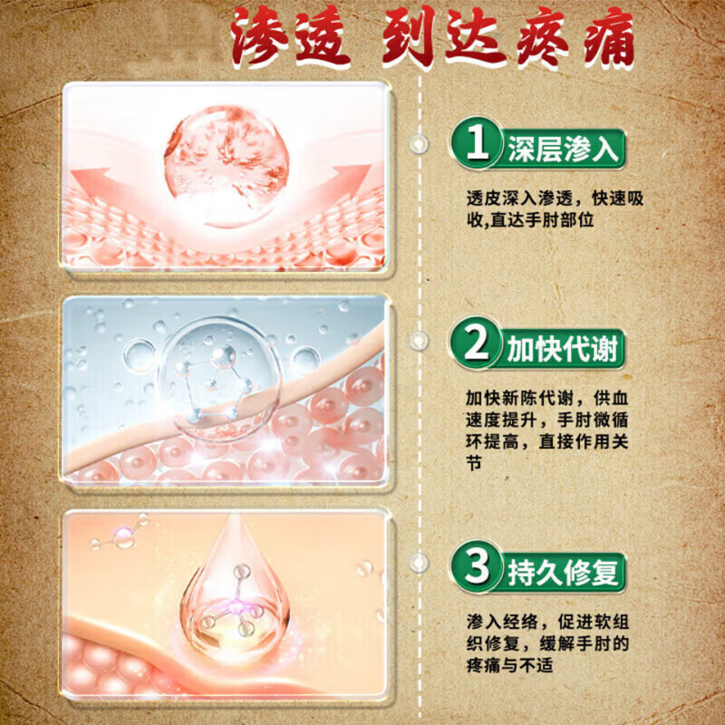 MRYU鹿元宁网球肘喷剂网球肘的特姣药官方正品手肘关节损伤疼痛麻木 5瓶装【巩固装】多年顽固症状 【官方直售】