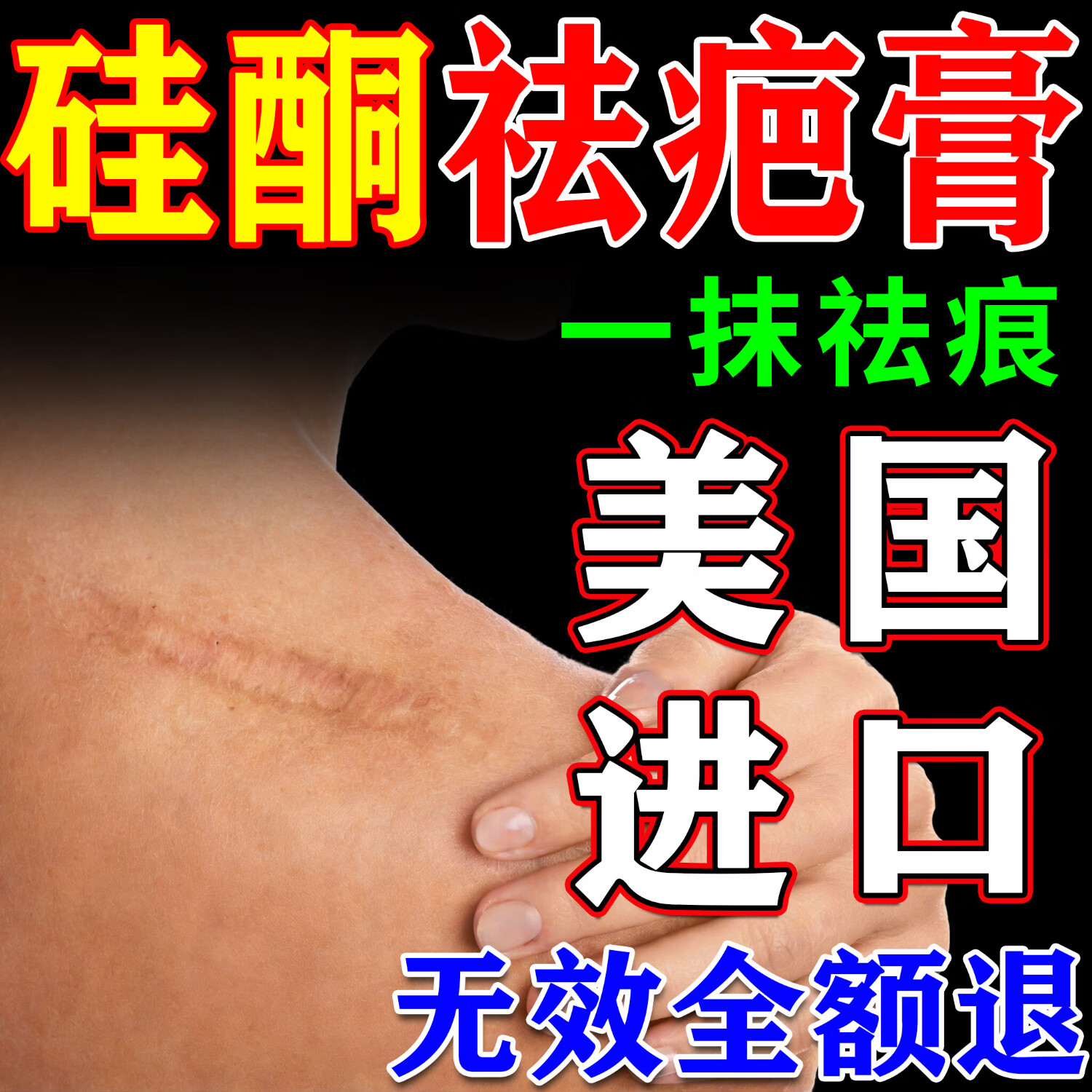 芭克疤克巴克祛疤膏美国进口去疤痕修复正品凝胶剖腹产烫伤膏儿童专用 特效三盒【彻底祛疤 永久无痕  15g*3】bale 祛疤膏脸部专用医用疤痕手术缝针伤疤修复硅酮凝胶除疤