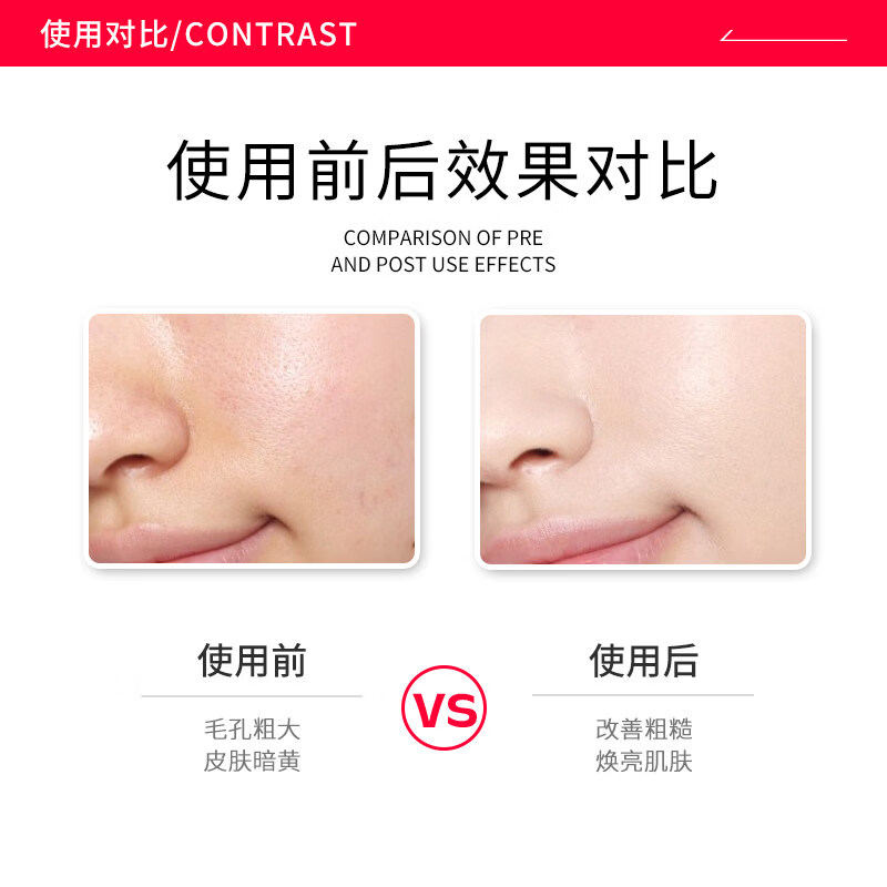 散刻【正品保障】BbLAB苾莱宝复活草涂抹面膜2.0补水保湿修护医用 175g