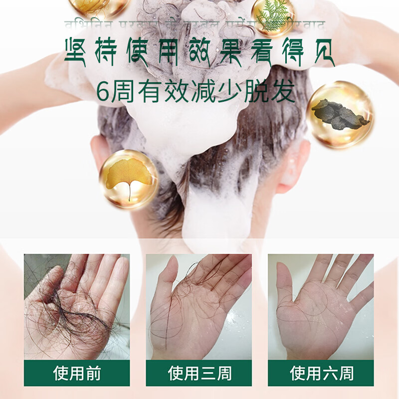 丝露杰(SLUJ)侧柏叶防脱洗发水;养发防断发 控油固发蓬松温和护发防断发正品 500ml