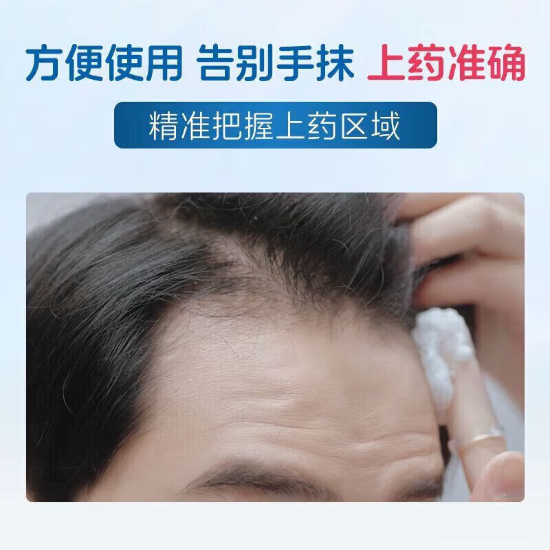 蔓迪新款蔓迪米诺上药神器神器头发滚珠头部涂抹按摩上药器 泡沫微孔渗透【泡沫涂抹器】