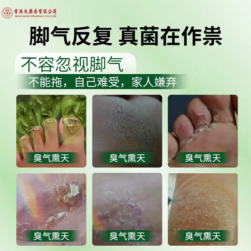 香港大药房真菌王草本皮肤膏全身可用痒私处手足护理温和旗舰 1瓶【单瓶体验】推荐周期装
