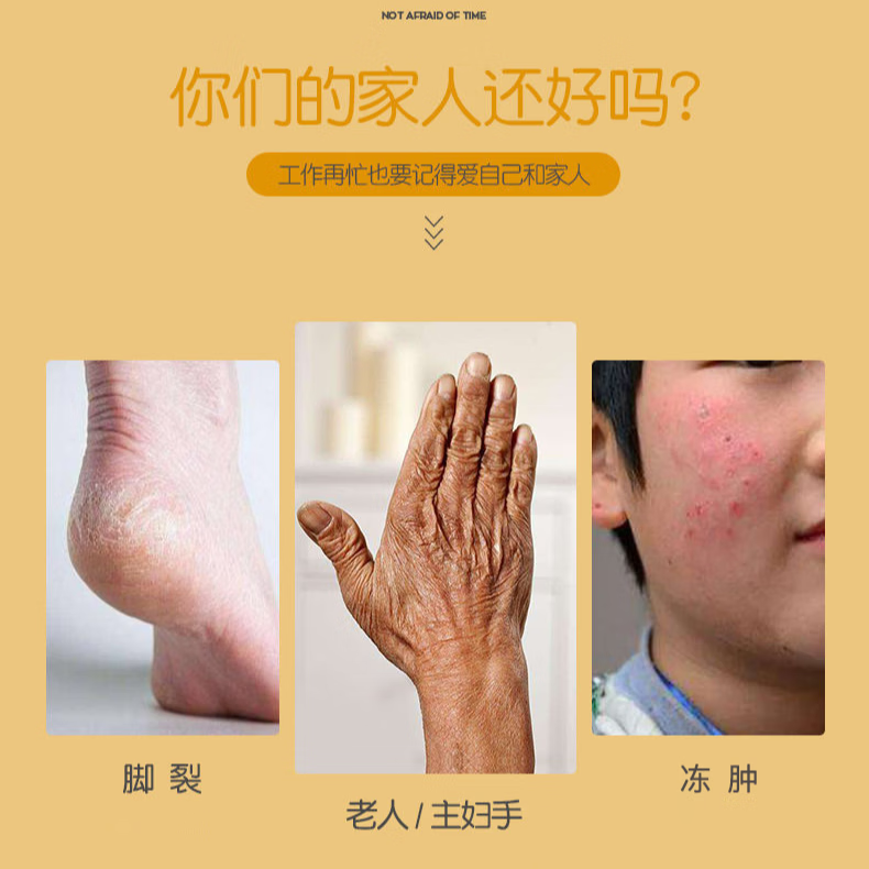 修正马油手足修护霜手脚干燥脱皮开裂足跟干裂干纹滋润保湿36克/瓶 3瓶【马油手足修护霜】