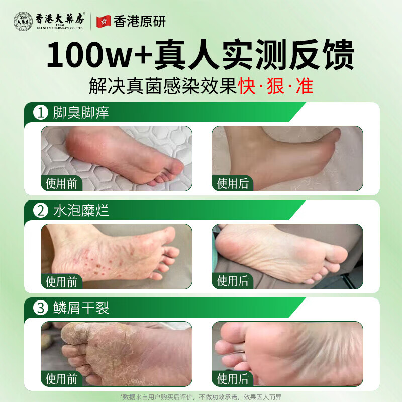 香港大药房有限公司真菌王皮肤瘙痒真菌感染私处抑菌阴囊潮湿大腿内侧肛门男女通用 1瓶【严重真菌感染】不划算 香港大药房有限公司真菌王皮肤瘙痒真菌感染私处抑菌阴囊潮湿大腿内侧肛门男女通用 1瓶【严重真菌感染】不划算