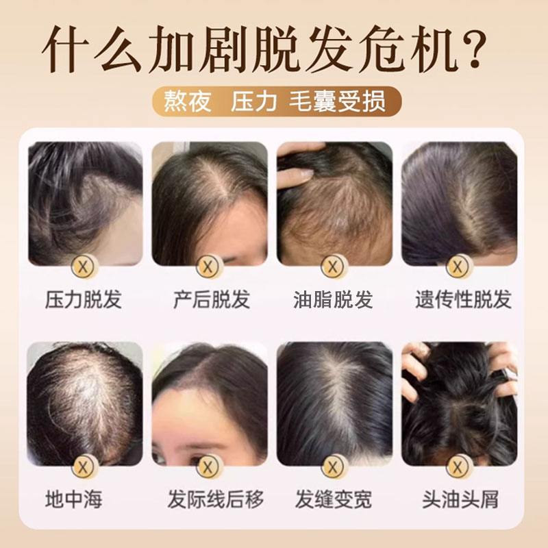 青叶炫老姜王防断发洗发水 生姜何首乌强韧去屑止痒控油洗头水洗头膏 老姜王防断发洗发水500ml