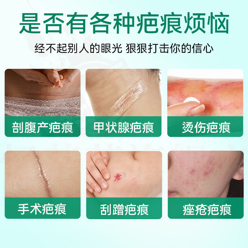 MRYUbberfer疤痕贴剖腹产手术后腹产增生烧烫伤硅酮贴【官方旗舰店正 1盒见效装 官方自售