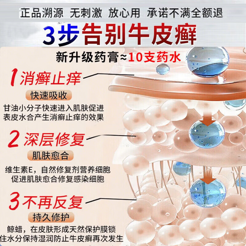 北京协和医学院银屑病药膏生物制剂针顽固皮癣专用真菌止痒皮肤治瘙痒断i根药膏 特强效1盒【一抹見效】原装正品 银屑病牛皮癣皮肤癣专用特强效膏
