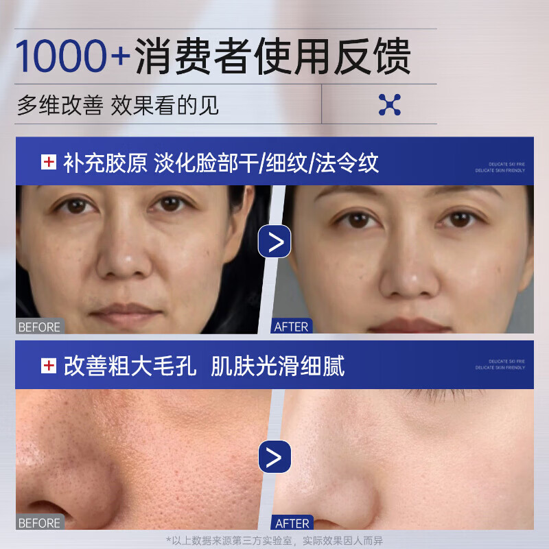 鹿角卉EAK护理膜医用重组胶原蛋白凝胶皮肤修护敷料淡法令纹细毛孔 1支装【正品保障】 官方旗舰店