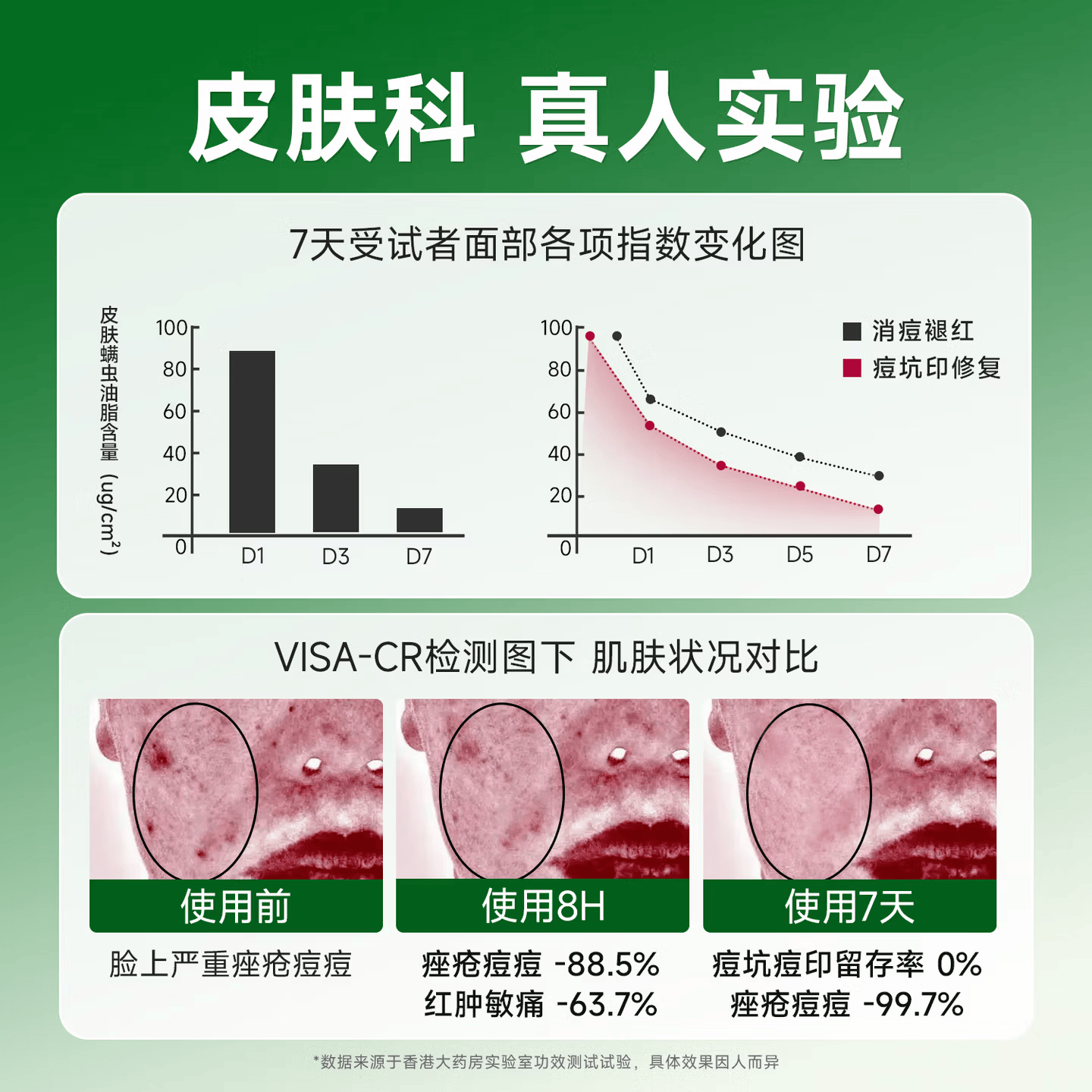 香港大药房祛痘膏和痘印坑修复痘痘和痘印青春痘消炎痤疮粉刺专用学生青少年 1瓶【买2送1】三盒一周期