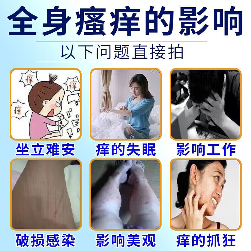 修正神经性皮炎专用非药顽固特傚效药皮炎湿疹神经性皮肤瘙痒无止痒非 九盒装买5送4包跟冶