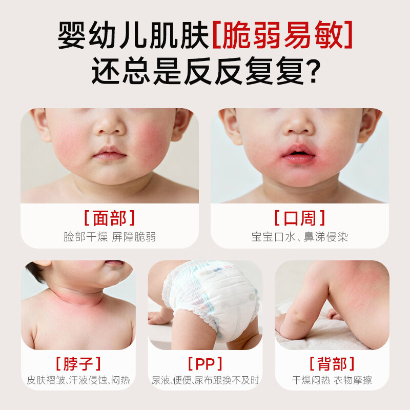 妙抚湿湿乐1号婴儿唇周舒缓口水膏宝宝滋润保湿面霜疹非激素止痒膏 【隔离预防】湿湿乐1号10g