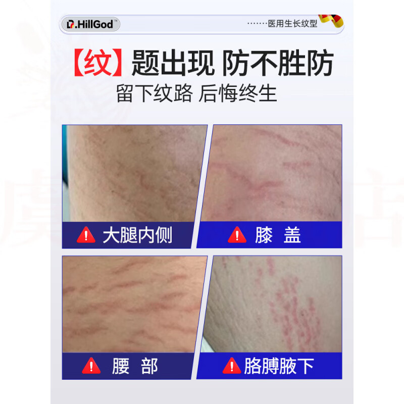 熏姿颜beerfer修纹膏产后修复生长纹产后去除肥胖纹淡黑色素沉积部位淡 5瓶 囤货装 官方直售