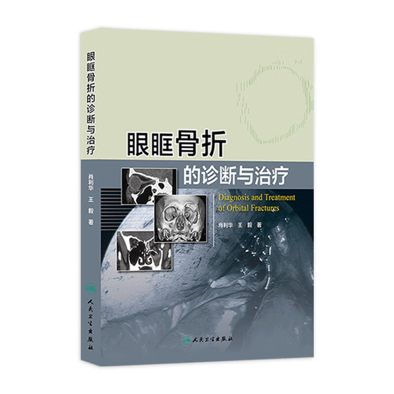 眼眶骨折的诊断与治疗