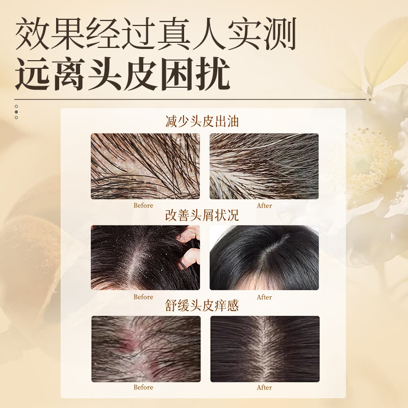 阿道夫(ADOLPH)天然成分洗发水香氛袪屑止痒洗发露持久留香 茶麸袪屑止痒洗发水350ml*2