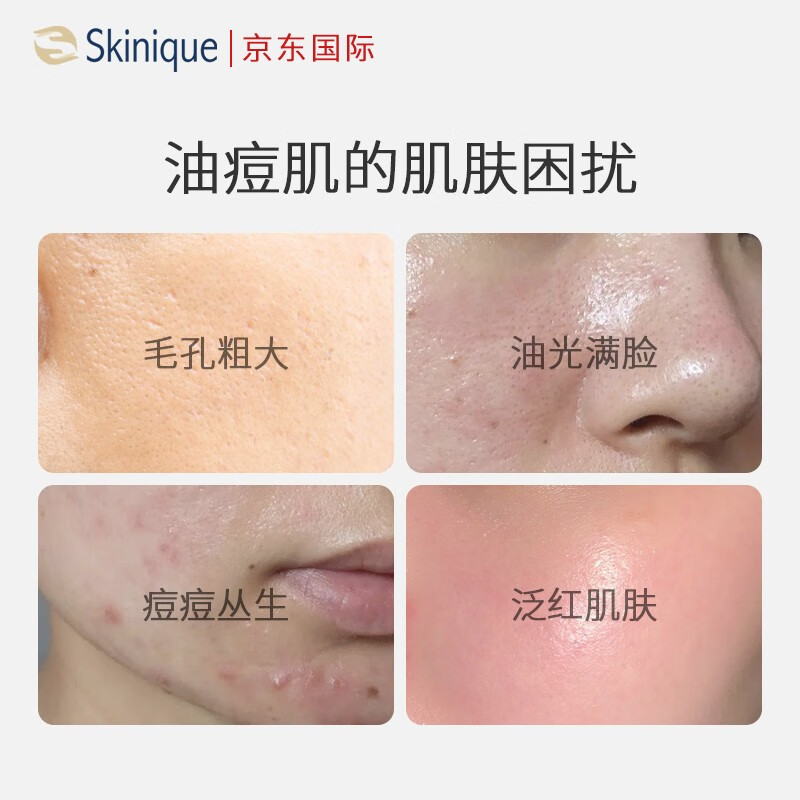 杏肌宁(Skinique)控油爽肤水喷雾120ml 补水保湿水改善痘痘泛红收缩毛孔护肤品礼物