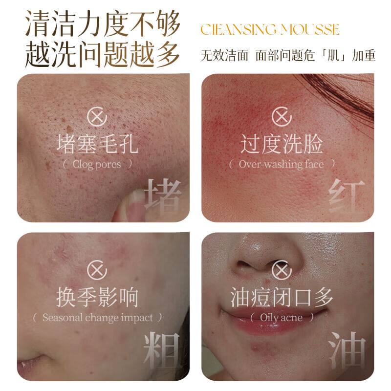 中农蜂研蜂蜜植萃氨基酸洁面慕斯 温和敏感肌友好 300ml