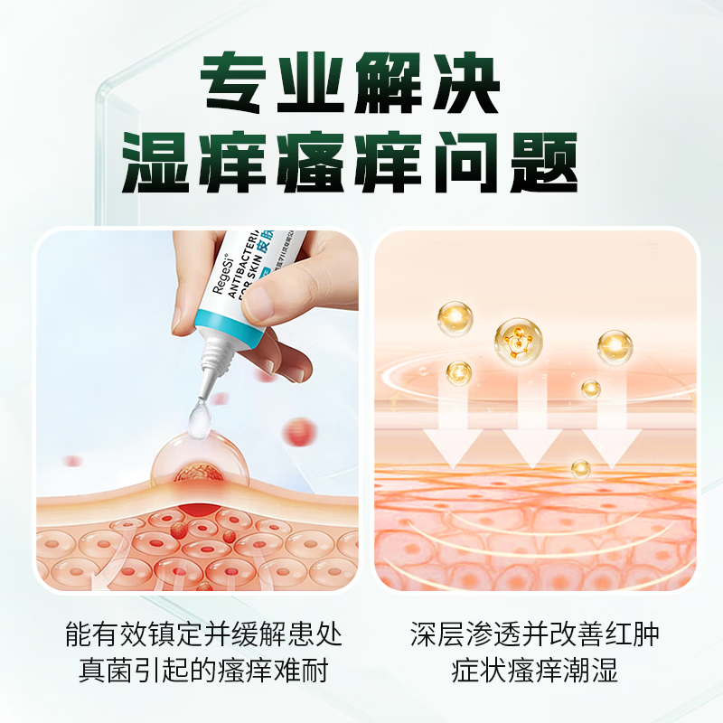 锐杰斯（Regesi）皮肤抑菌膏外用抑菌止痒软膏安全无激素官方正品15g 皮肤抑菌膏15g*2支