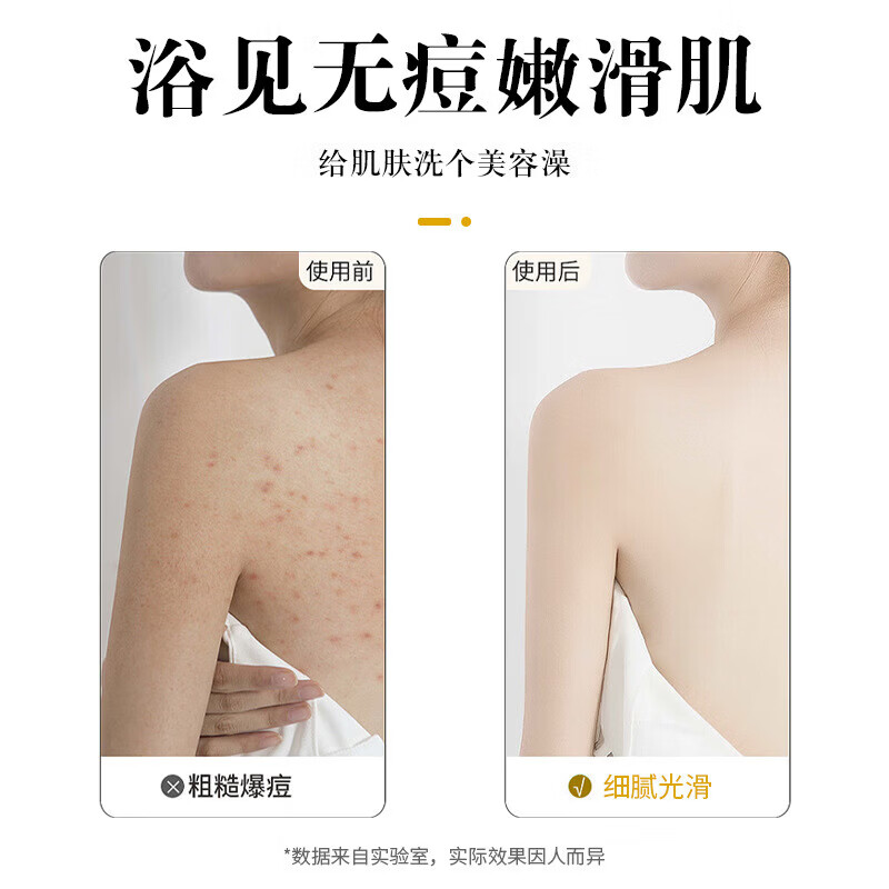 立美丝硫磺沐浴露液体香皂后背螨虫专用硫黄皂洗脸洗澡 硫磺除螨沐浴露400mL