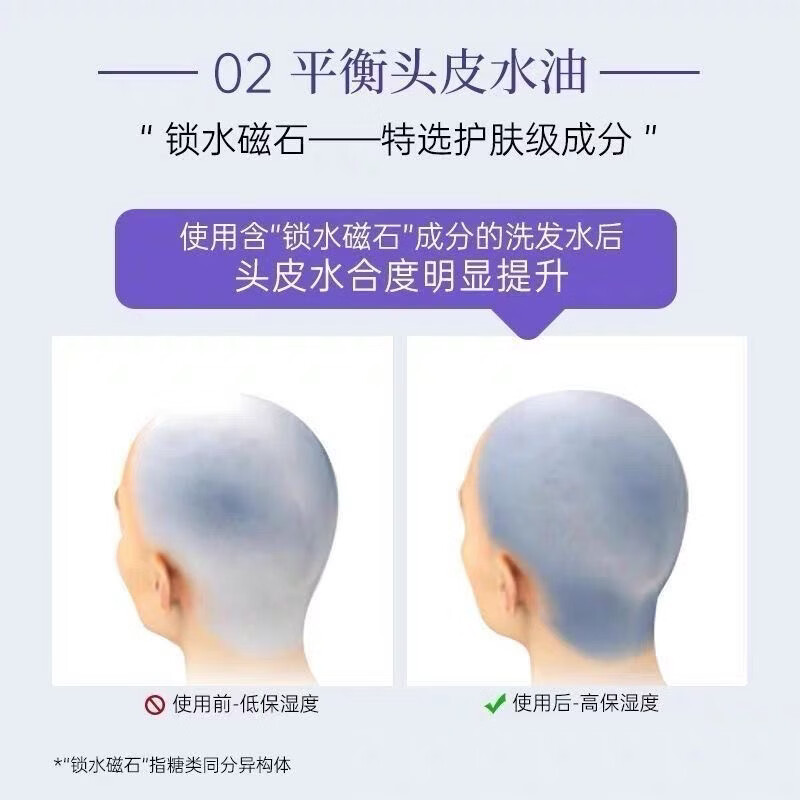 康王去屑控油止痒二硫化硒洗发液蓬松洗头膏洗发露头皮去屑控油洗发水 紫瓶丰盈蓬松型一瓶