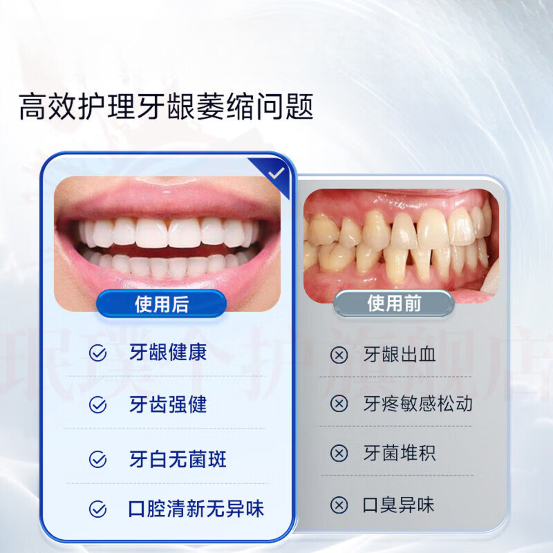 思亚希俊小白牙龈i萎缩护理牙膏羟基磷灰石修护牙齿出血松动周炎脱敏剂 2支装【护龈固齿 出血改善】 官方自售