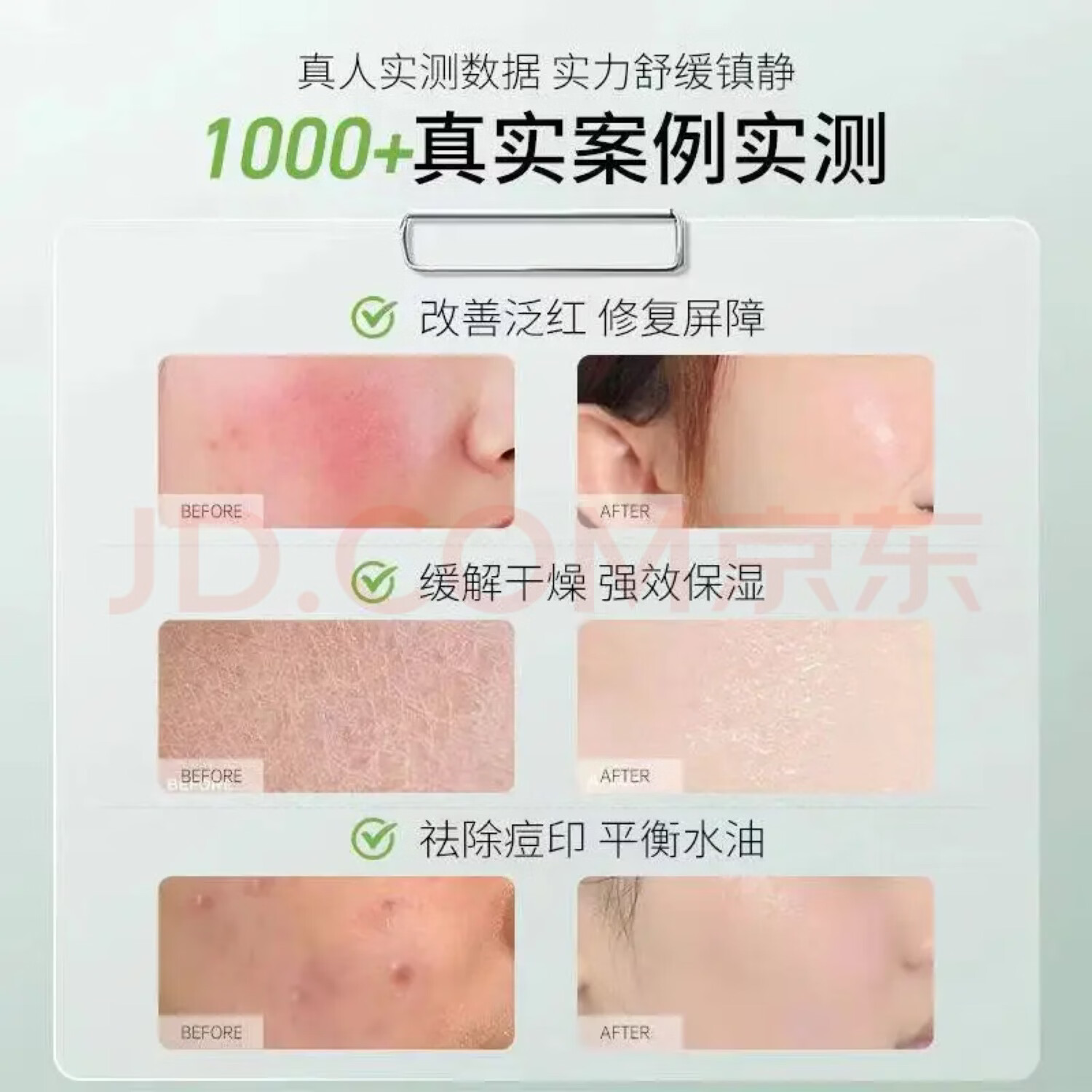 完美芦荟胶正品支持扫码查验不刮码老牌子老品牌保湿补水 10只【正品保证 支持扫码查验】