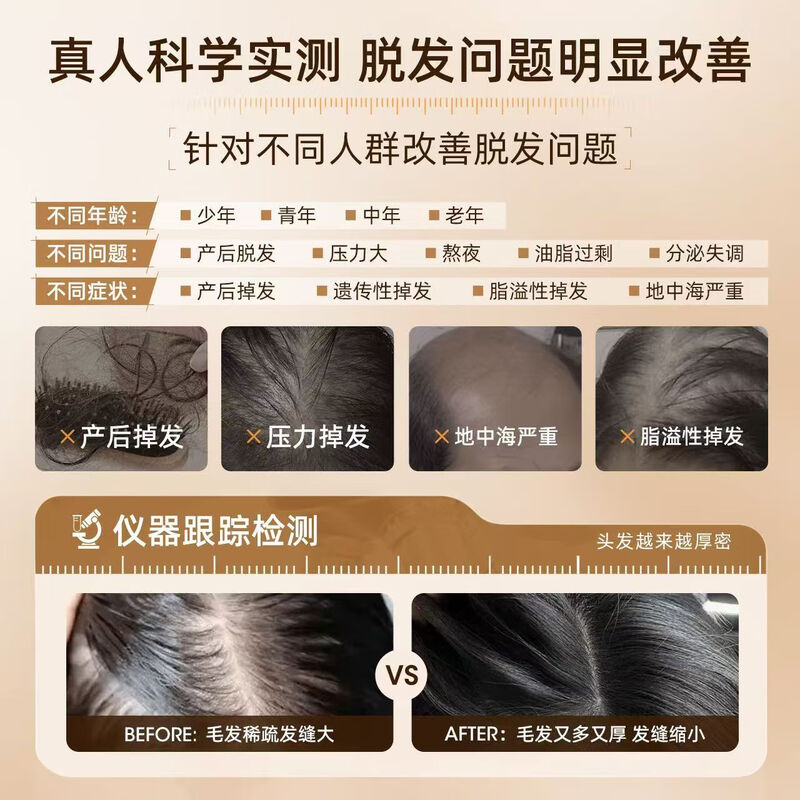 三个魔发匠防脱洗发水可比落精华洗发露控油去屑侧柏叶生姜洗头膏男女士 【升级第二代】防脱精华洗发乳480g