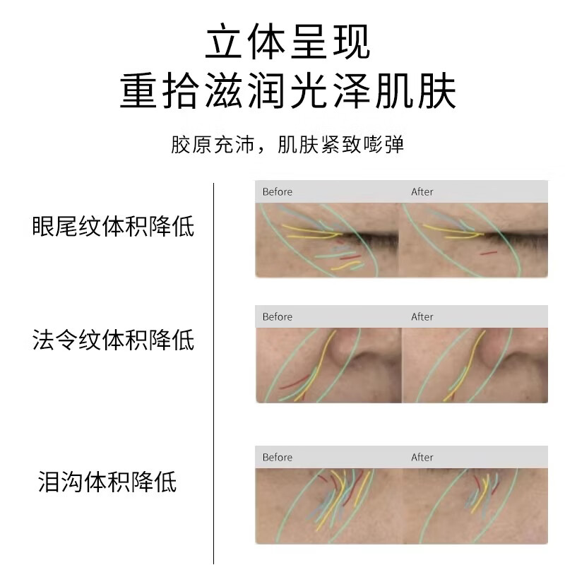 千袖TSleeves千袖精粹水焕亮莹润精华水紧致嘭弹湿敷水正品 115ml【单瓶装】