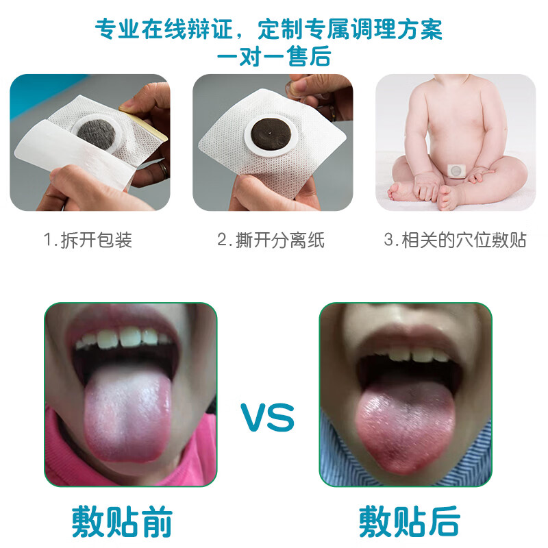 啵贝尔 小儿脾胃贴 儿童成人胃口不好脾贴 宝宝不爱吃饭肚脐穴位贴膏 脾胃 5盒/30贴