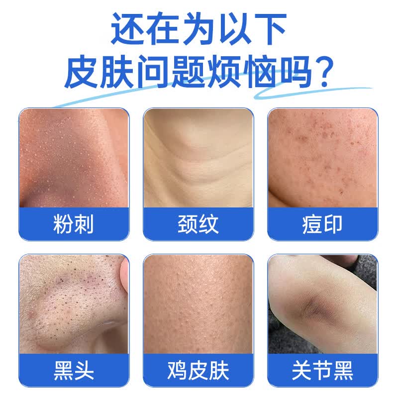 [恒医森]维A酸乳膏 0.05%*17g 2盒装 0.05%*17g 祛痘印修复淡化痘印痘坑修复祛痘药膏凝胶祛斑改善黑色素鸡皮肤 淡色沉印