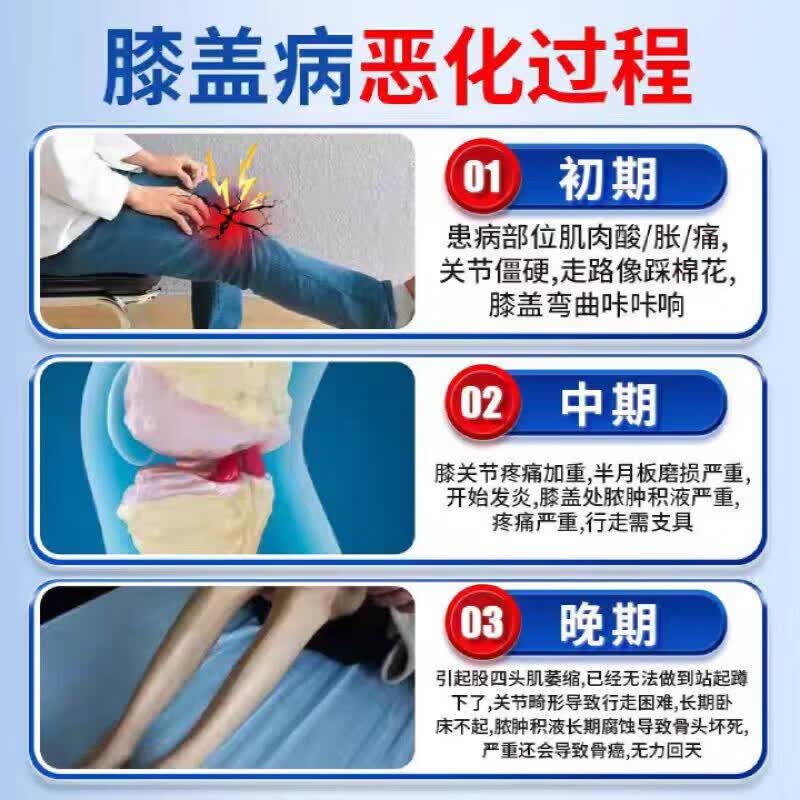 MRYU奥美宁骨舒宝膝盖关节疼痛消炎类风湿性关节炎贴肌肉劳损通风 【买5送4】9盒 疗程装 官方直售 京质保障