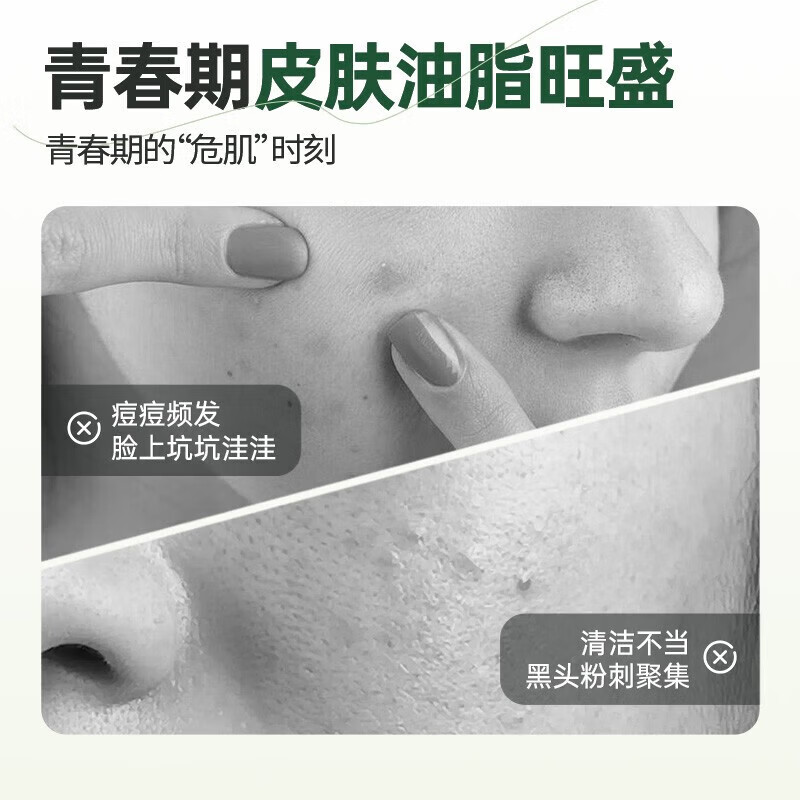 袋鼠杰克青少年儿童氨基酸洗面奶控油祛痘洁面乳祛黑头缩毛孔清洁男孩女孩 【温和洁面】青少年洁面乳100g*1支