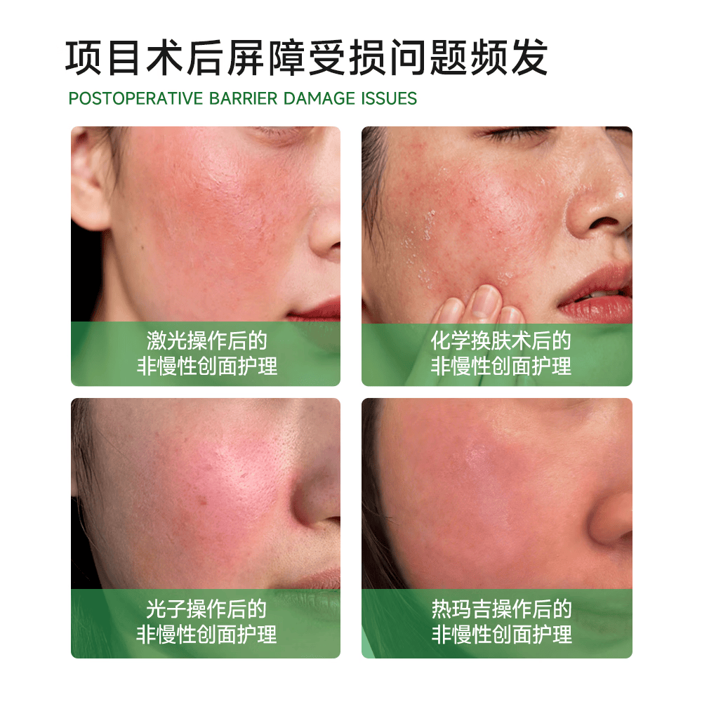 自然攻略医用重组III型人源化胶原蛋白修复敷料贴械字号创面术后护理蓝膜 【10盒装】年货囤货装