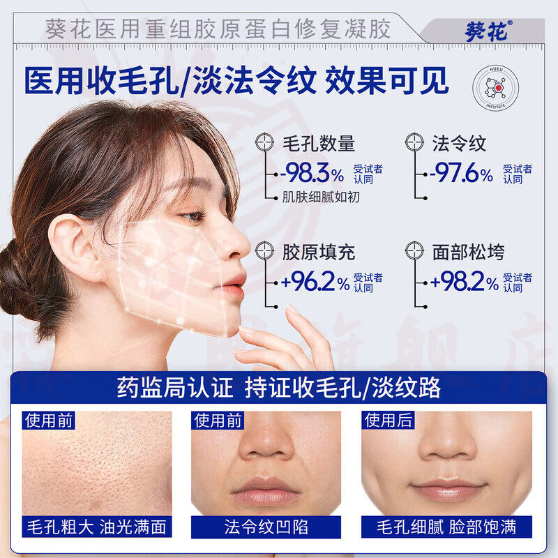 思亚希kuuz凝胶毛孔粗大收缩修复抬头法令纹淡化口角囊袋面部松弛皱纹 一盒体验装(20g) 官方直售