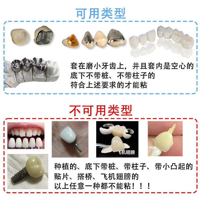 假牙烤瓷牙粘合剂医用牙胶全瓷牙冠牙齿义齿固定粘接剂专用强力胶 顶配款【800%不脱落】全套工具 三甲医院同款永久稳固