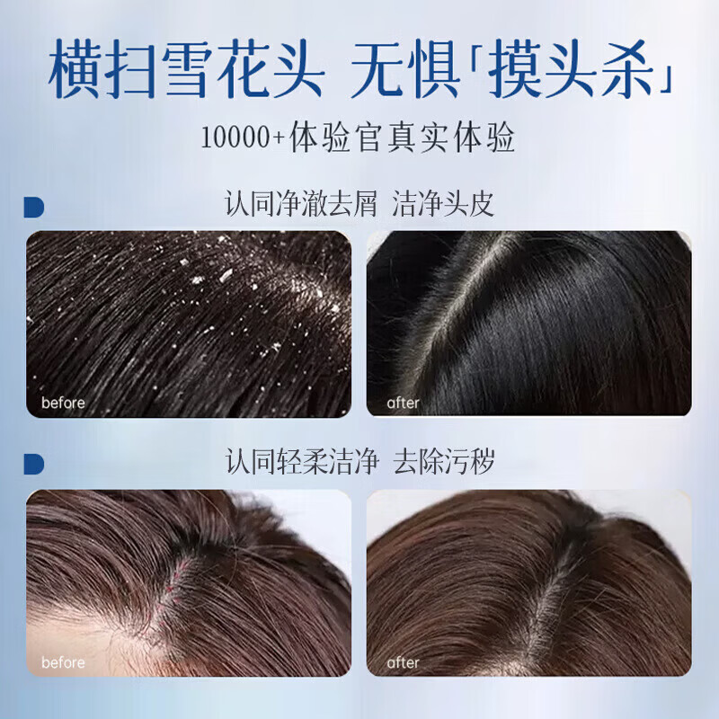 KERLY达护佳洗发水【官方旗舰正品】控油蓬松去屑止痒除螨洗头膏露 【巩固装】买三赠二 5瓶装 官方直售