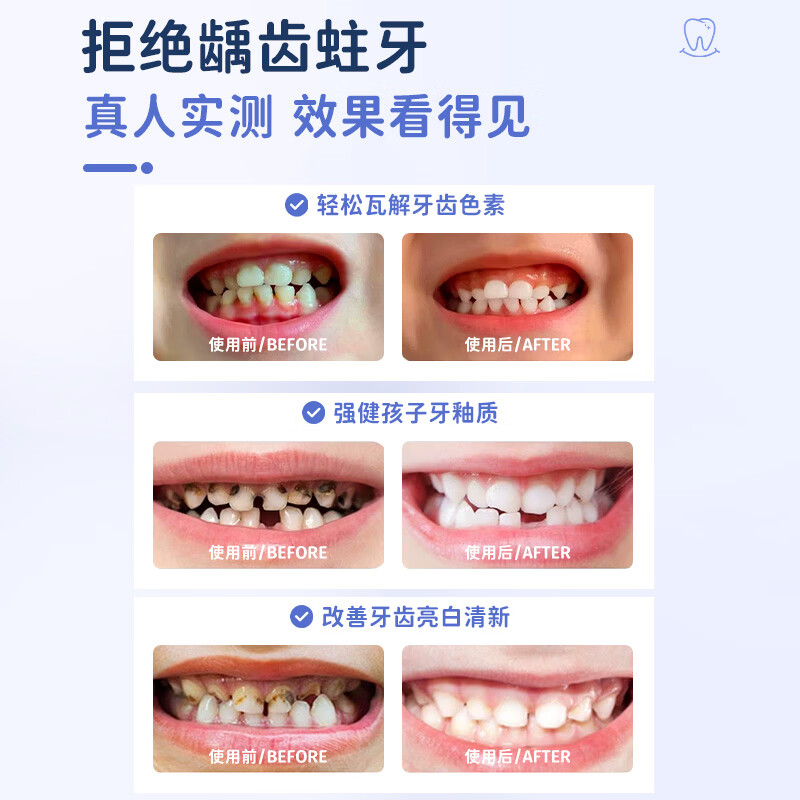 海洋主义 SOCUS儿童牙膏3-6-12岁含氟奥拉氟防蛀牙抗糖牙洞去渍护龈青少年 【草莓味】防蛀护齿80g*2