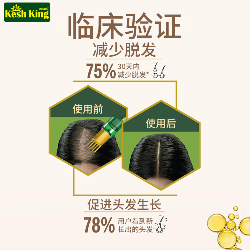 KESH KING印度原装进口阿育吠陀洗发水21味草本防脱发去屑止痒控油男女通用 【发油】100ml*1瓶
