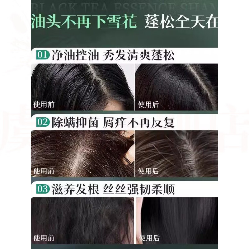 熏姿颜为肯植物去屑洗发水何首乌植萃去屑止痒控油修护烫染抚平毛躁干枯 5瓶 囤货装 官方直售